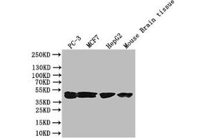 Western Blot Positive WB detected in: PC-3 whole cell lysate, Mouse liver tissue All lanes: DGAT2 antibody at 3 μg/mL Secondary Goat polyclonal to rabbit IgG at 1/50000 dilution Predicted band size: 44, 40 kDa Observed band size: 44 kDa (DGAT2 antibody  (AA 1-66))