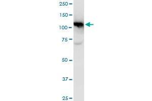 CAND1 polyclonal antibody (A01), Lot # 051005JC01. (CAND1 antibody  (AA 1-100))