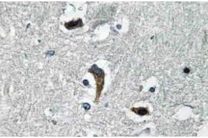 Immunohistochemistry (IHC) analyzes of MaxiKbeta antibody in paraffin-embedded human brain tissue. (KCNMB1 antibody)