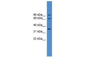 Western Blot showing CCIN antibody used at a concentration of 1-2 ug/ml to detect its target protein. (Calicin antibody  (N-Term))