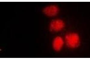 Immunofluorescent analysis of XPV staining in HepG2 cells. (POLH antibody)