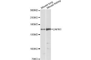 Western blot analysis of extracts of various cell lines, using DAPK1 Antibody (ABIN2562144) at 1:1000 dilution.