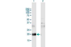 Western Blot analysis of CD81 expression in transfected 293T cell line by CD81 MaxPab polyclonal antibody. (CD81 antibody  (AA 1-236))