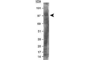 Western blot analysis of LRP8 in mouse brain membrane lysate using LRP8 polyclonal antibody . (LRP8 antibody  (AA 800-900))