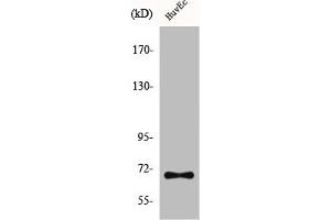 Western Blot analysis of HuvEc cells using CTPS Polyclonal Antibody (CTP Synthase antibody  (N-Term))