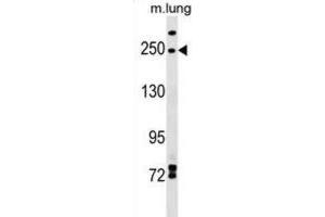 Western Blotting (WB) image for anti-Inverted Formin, FH2 and WH2 Domain Containing (INF2) antibody (ABIN2999620)