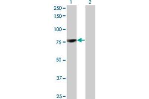 Western Blot analysis of PRKCD expression in transfected 293T cell line by PRKCD monoclonal antibody (M07), clone 8E12. (PKC delta antibody  (AA 577-676))