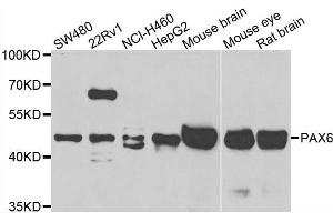 Western blot analysis of extracts of various cell lines, using PAX6 antibody. (PAX6 antibody  (AA 1-300))