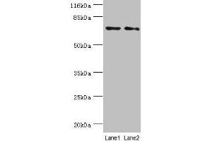 Western blot All lanes: MAGEC3 antibody at 2 μg/mL Lane 1: A375 whole cell lysate Lane 2: Rat thymus tissue Secondary Goat polyclonal to rabbit IgG at 1/10000 dilution Predicted band size: 72, 39 kDa Observed band size: 72 kDa