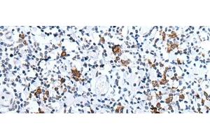 Immunohistochemistry of paraffin-embedded Human tonsil tissue using HCRT Polyclonal Antibody at dilution of 1:25(x200) (Orexin antibody)