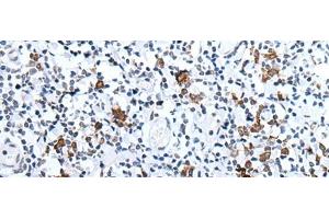 Immunohistochemistry of paraffin-embedded Human tonsil tissue using HCRT Polyclonal Antibody at dilution of 1:25(x200)