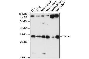 Western blot analysis of extracts of various cell lines, using TACO1 antibody (ABIN6292793) at 1:1000 dilution. (TACO1 antibody)