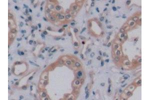 Detection of VEGF165 in Human Kidney Tissue using Monoclonal Antibody to Vascular Endothelial Growth Factor 165 (VEGF165) (VEGF 165 (AA 28-191) antibody)