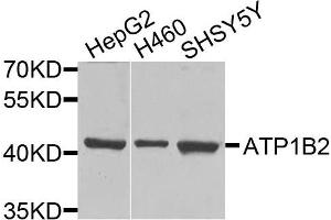 Western blot analysis of extracts of various cells, using ATP1B2 antibody. (ATP1B2 antibody)