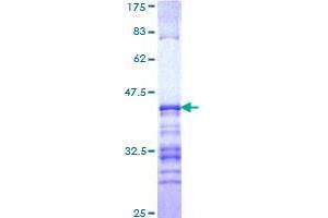 GATAD2A Protein (AA 26-134) (GST tag)
