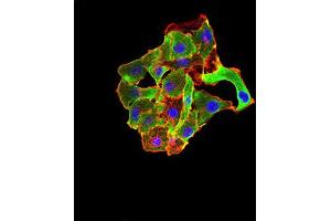Immunocytochemistry (ICC) image for anti-TNF Receptor-Associated Factor 2 (TRAF2) (AA 39-188) antibody (ABIN5896378) (TRAF2 antibody  (AA 39-188))