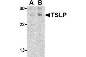 Western blot analysis of TSLP in Jurkat cell lysate with this product at (A) 1 and (B) 2 μg/ml.