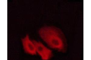 ABIN6267408 staining Hela cells by ICC/IF. (PKC antibody  (pThr497))