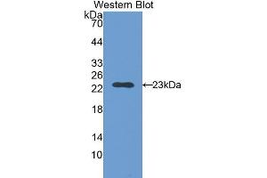 Western Blotting (WB) image for anti-Slow Skeletal Troponin I (TNNI1) (AA 1-187) antibody (ABIN1176057) (TNNI1 antibody  (AA 1-187))