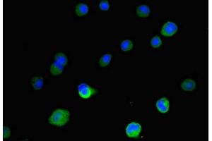 Immunofluorescence (IF) image for anti-Insulin-Like Growth Factor 2 mRNA Binding Protein 3 (IGF2BP3) (AA 1-100) antibody (ABIN7156360)