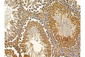 ABIN7095754 and ABIN7099816 at 1/100 staining rat testis tissue by IHC-P. (ERVK-18 antibody)