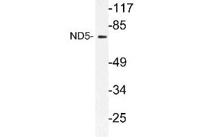 Western blot (WB) analysis of ND5 antibody in extracts from HT-29 cells.