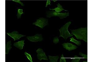 Immunofluorescence of monoclonal antibody to DLX5 on HeLa cell. (DLX5 antibody  (AA 191-279))