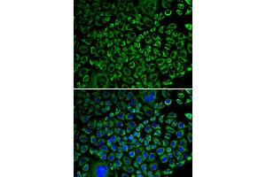 Immunofluorescence analysis of A549 cell using F10 antibody. (Coagulation Factor X antibody  (AA 235-488))