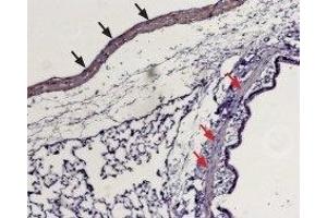 Expression of Sphingosine 1-phosphate receptor 1 in rat lung - Immunohistochemical staining of paraffin embedded rat lung sections using Anti-S1PR1 (EDG1) (extracellular) Antibody (ABIN7043771, ABIN7045270 and ABIN7045271), (1:100). (S1PR1 antibody  (Extracellular, N-Term))