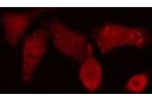 ABIN6276815 staining NIH-3T3 cells by IF/ICC.