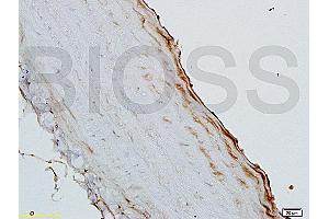 GM-CSF antibody  (AA 71-141)