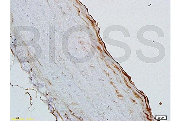 GM-CSF antibody  (AA 71-141)