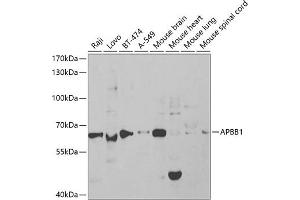 Western blot analysis of extracts of various cell lines, using  antibody (ABIN6129919, ABIN6136973, ABIN6136974 and ABIN6219091) at 1:1000 dilution. (FE65 antibody  (AA 359-708))