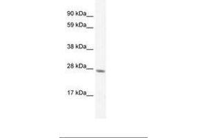 Image no. 2 for anti-General Transcription Factor IIF, Polypeptide 2, 30kDa (GTF2F2) (C-Term) antibody (ABIN6735897) (GTF2F2 antibody  (C-Term))