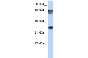 WB Suggested Anti-NKX3-2 Antibody Titration: 0. (NKX3-2 antibody  (N-Term))