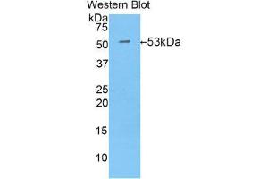 Western Blotting (WB) image for anti-Isocitrate Dehydrogenase 1 (NADP+), Soluble (IDH1) (AA 99-325) antibody (ABIN1859250) (IDH1 antibody  (AA 99-325))