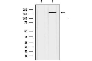 anti-ATP-Binding Cassette, Sub-Family C (CFTR/MRP), Member 5 (ABCC5) (N-Term) antibody