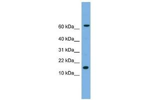 IL1 beta antibody used at 1 ug/ml to detect target protein. (IL-1 beta antibody  (N-Term))