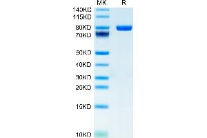 Human CD5 on Tris-Bis PAGE under reduced condition. (CD5 Protein (CD5) (AA 25-371) (Fc-Avi Tag))