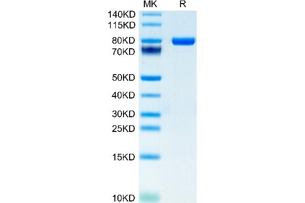 CD5 Protein (CD5) (AA 25-371) (Fc-Avi Tag)