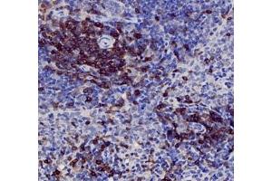 Immunohistochemistry (Paraffin-embedded Sections) (IHC (p)) image for anti-CD3 (CD3) antibody (ABIN7073386)