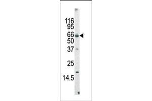 Image no. 1 for anti-Protein AF-9 (MLLT3) (Middle Region) antibody (ABIN358674) (AF9 antibody  (Middle Region))