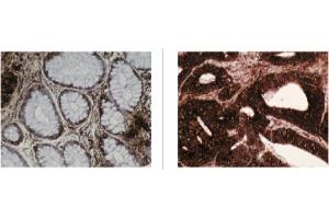 Image no. 1 for anti-Chaperonin Containing TCP1, Subunit 2 (Beta) (CCT2) antibody (ABIN211312) (CCT2 antibody)