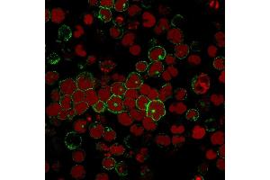 Immunofluorescence staining of MOLT-4 cells using CD2 Mouse Monoclonal Antibody (BH1) followed by goat anti-Mouse IgG conjugated to CF488 (green). (CD2 antibody)