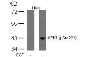 Western blot analysis of extracts from Hela cells untreated or treated with EGF using MEK1(Phospho-Ser221) Antibody. (MEK1 antibody  (pSer221))