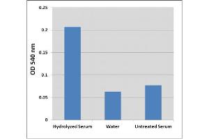 Detection of hydroxyproline in human serum. (Hydroxyproline Assay Kit)