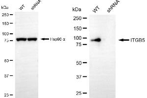 Western blotting analysis using ITGB5 antibody (ABIN7799074). (Recombinant Integrin beta 5 antibody)