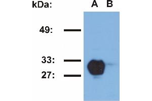 Western blotting analysis of HLA-DR1 in Raji (A) and Jurkat (B) cell lines using MEM-267 antibody. (HLA-DR1 antibody)