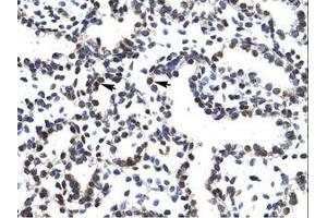 Image no. 1 for anti-LIM Homeobox 3 (LHX3) (AA 211-260) antibody (ABIN202432) (LHX3 antibody  (AA 211-260))