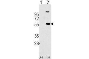 Western blot analysis of ALDH1A1 antibody and 293 cell lysate (2 ug/lane) either nontransfected (Lane 1) or transiently transfected with the ALDH1A1 gene (2). (ALDH1A1 antibody  (AA 302-331))